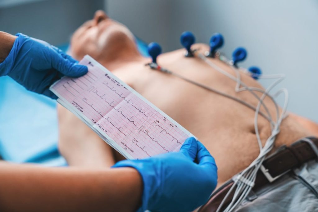 Electrocardiogram